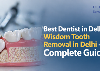 Best Dentist in Delhi & Wisdom Tooth Removal in Delhi – Complete Guide